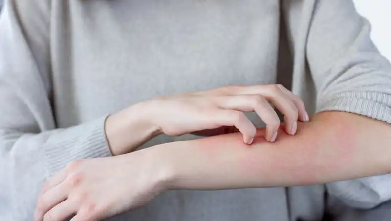 Cilt Kanseri Uyarısı: Dermatologdan Kaçırılmaması Gereken İki Belirti